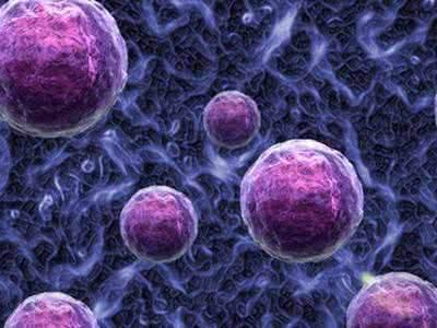 人卵巢癌多药耐药细胞形态