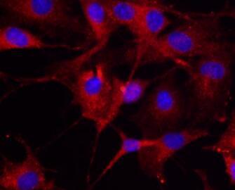大鼠骨髓内皮祖细胞（Rat Endothelial Progenitor Cells）