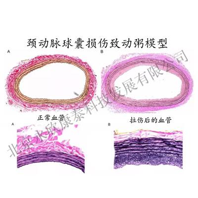 大鼠颈动脉球囊损伤、斑块、动脉硬化模型