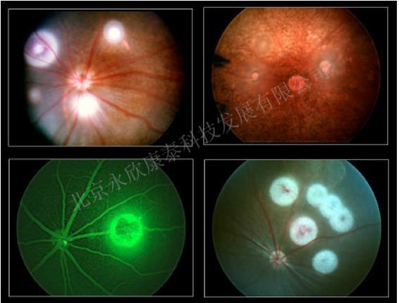 角膜、脉络膜新生血管模型（缝线法、囊袋法、激光法）（CNV）（CNV）