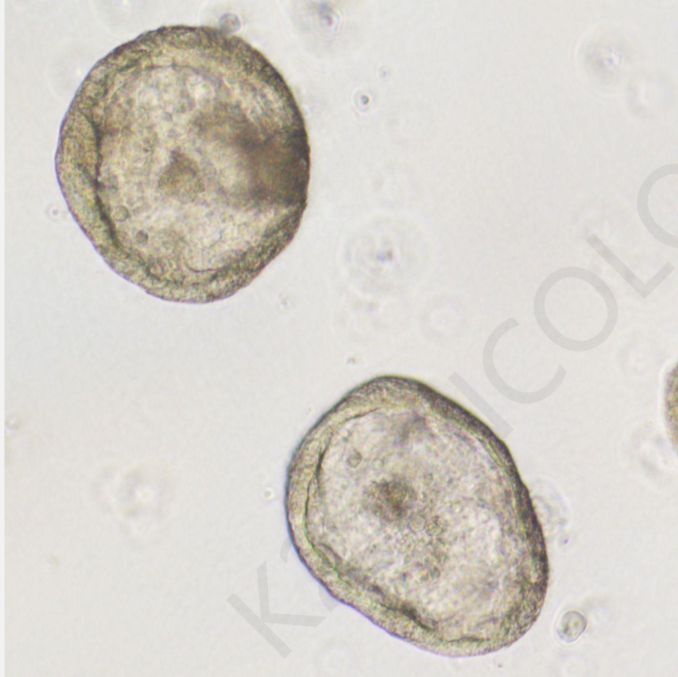 肿瘤类器官|​靶向claudin18.2的药物研发模型