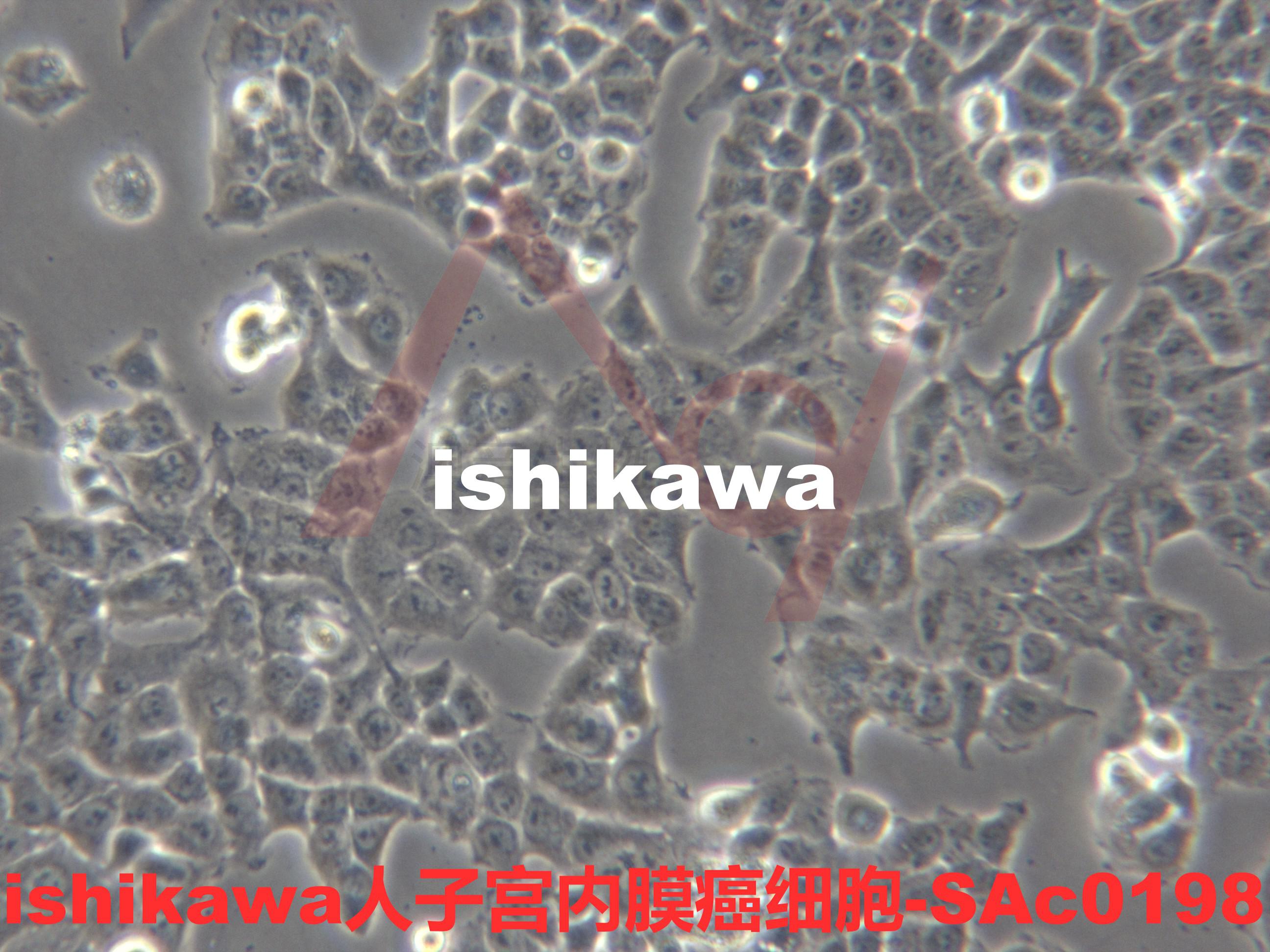 Ishikawa【ISHIKAWA; ISHI】子宫内膜癌细胞