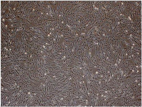 神经胶质瘤细胞(含str)