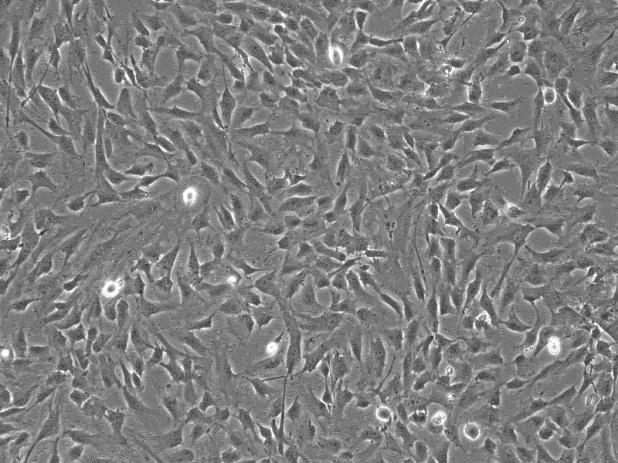 人脑血管平滑肌细胞 HBVSMC