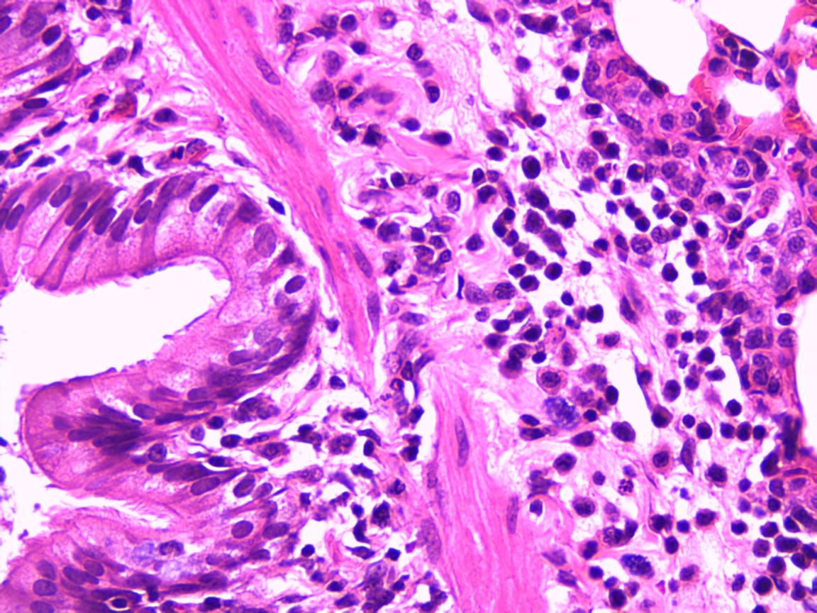 大鼠慢性阻塞性肺疾病(COPD)