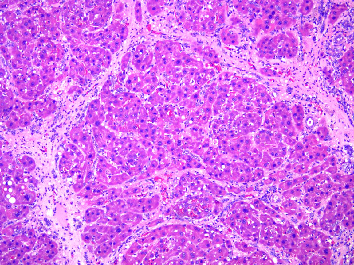 大鼠肝硬化模型构建