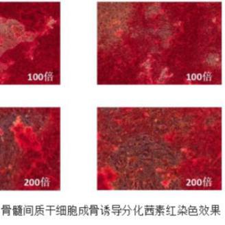 间充质干细胞（MSC）成骨诱导分化图/赛百慷