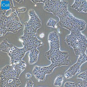 RT-4 人膀胱移行细胞乳头瘤/STR鉴定/赛百慷（iCell）