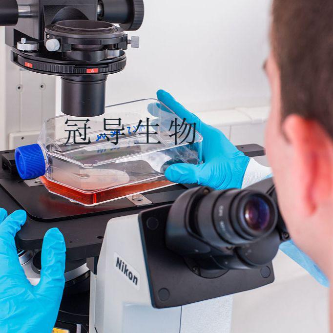 HPDLF：人牙周膜成纤维反复传代细胞|完全培养基