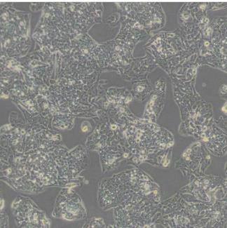 MB49 小鼠膀胱癌细胞