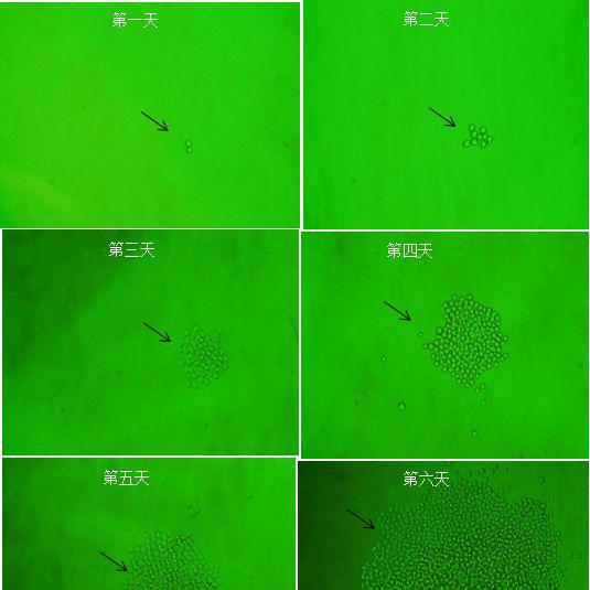视黄醇结合蛋白4抗体 视黄醇结合蛋白4单抗 鼠抗视黄醇结合蛋白4单克隆抗体