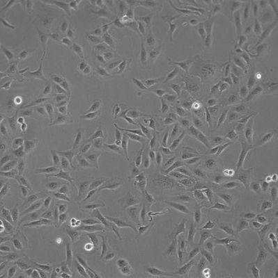 EJ膀胱癌细胞实验