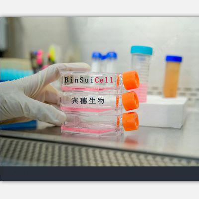 SF 539 Cells;人胶质瘤体外培养细胞|配套完全培养基