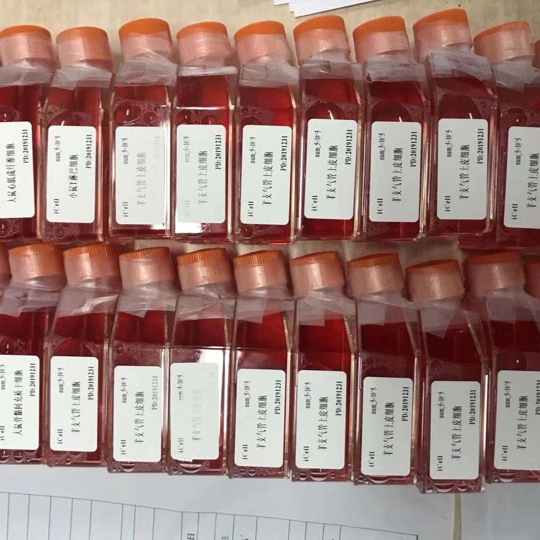 KMB-17 人胚肺二倍体细胞/赛百慷（iCell）