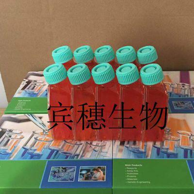 SW1783;人脑星形胶质瘤克隆复苏细胞|配套完全培养