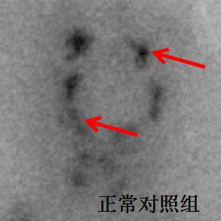 利用斑马鱼模型评价帕金森病防治作用