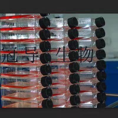 JM-Jurkat Cells;人急性T淋巴细胞白血病扩增细胞|STR鉴定图谱