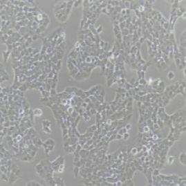 A-673 (人横纹肌肉瘤细胞)带鉴定