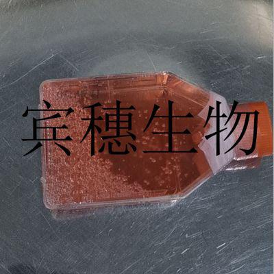 HUVEC人脐静脉血管内皮细胞种子库