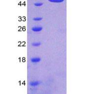 白介素6受体(IL6R)重组蛋白(多属种)