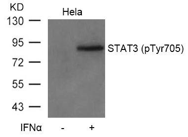 STAT3 (phospho Tyr705) antibody