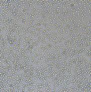 人冠状动脉内皮细胞HCAEC