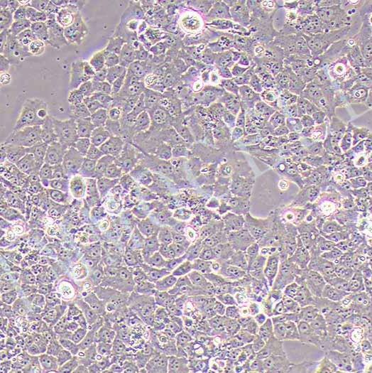 MS751人子宫颈表皮癌细胞丨MS751细胞丨STR鉴定