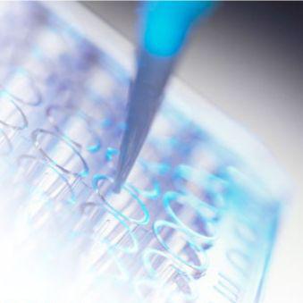 人小胶质细胞标志物 Iba1(IBA1)ELISA KIT/小胶质细胞标志物 Iba1(IBA1)ELISA KIT