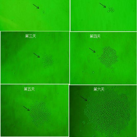 血清淀粉样蛋白A抗体 血清淀粉样蛋白A单抗 鼠抗血清淀粉样蛋白A配对单克隆抗体