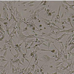 U-118 MG脑星形胶质母细胞瘤 