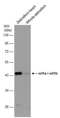Wt1a + Wt1b antibody