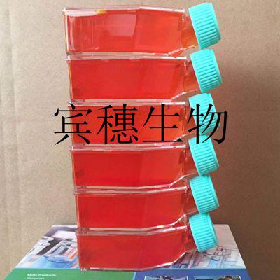 CFPAC;人胰腺导管癌活性好细胞|配套专用培养基