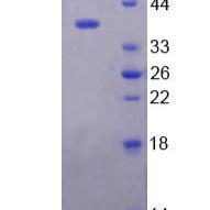 基质金属蛋白酶2(MMP2)重组蛋白(多属种)