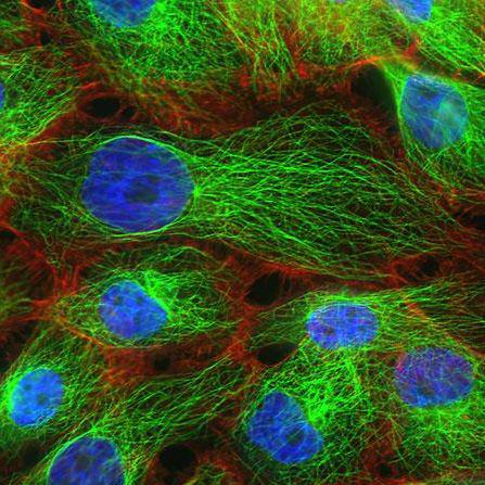 GC-2 spd细胞、GC-2 spd细胞、GC-2 spd细胞