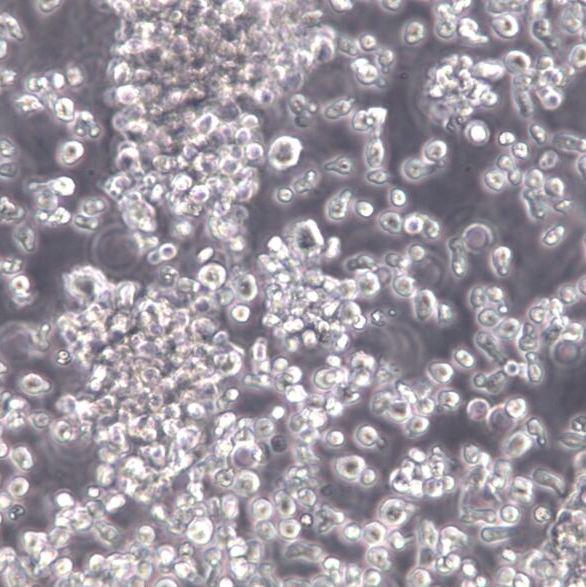 T2(174×CEM.T2)；人淋巴母细胞