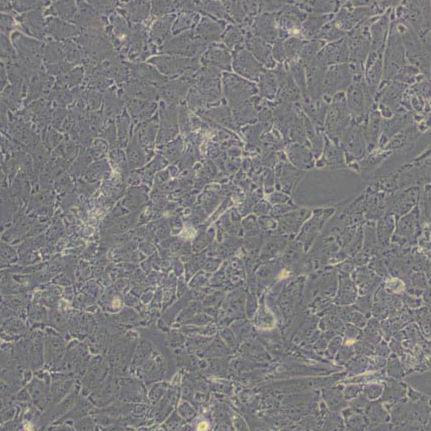 PED猪内皮细胞（带鉴定）