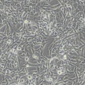 RD人恶性胚胎横纹肌瘤细胞(带STR鉴定)