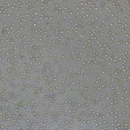 类风湿关节炎成纤维样滑膜细胞RA-FLSs