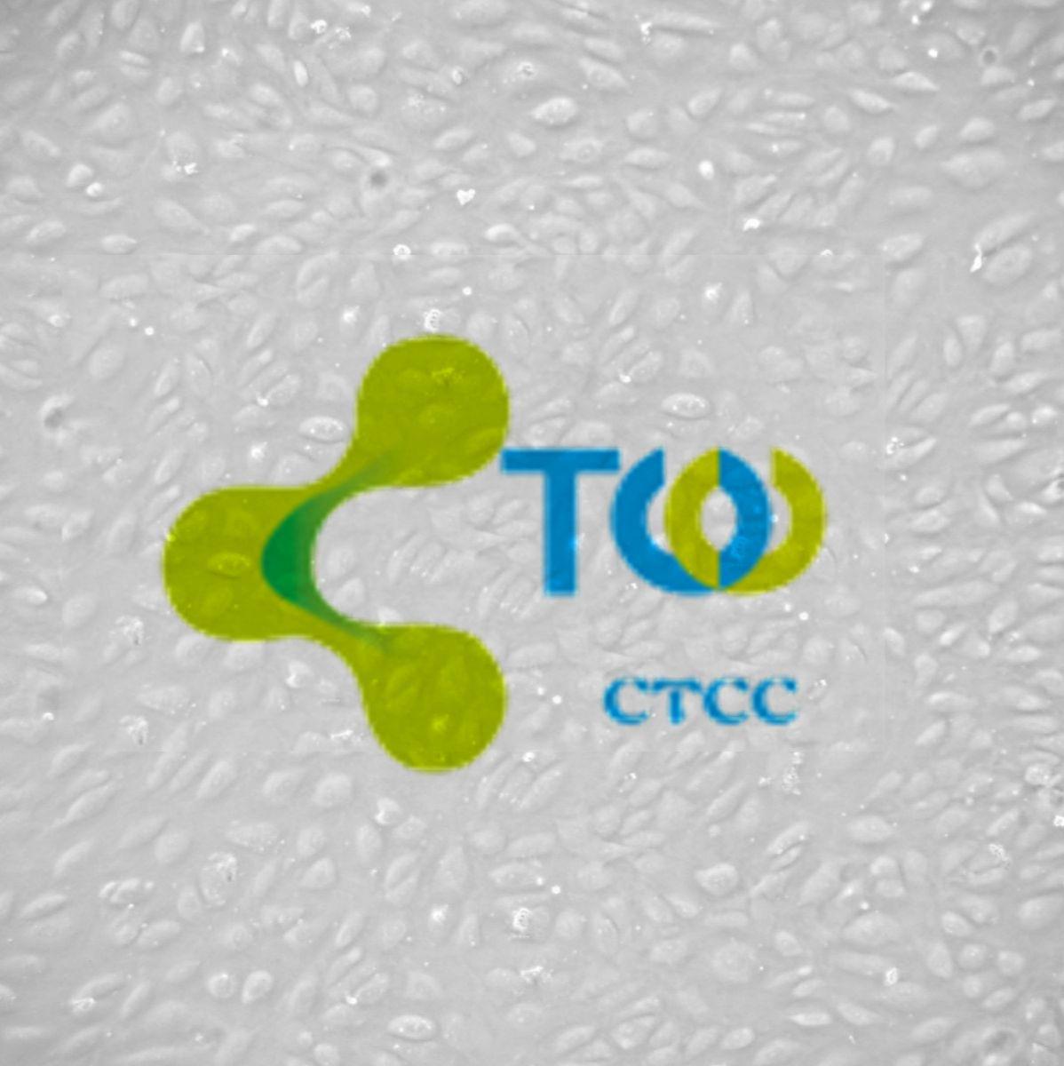 冠状动脉内皮细胞