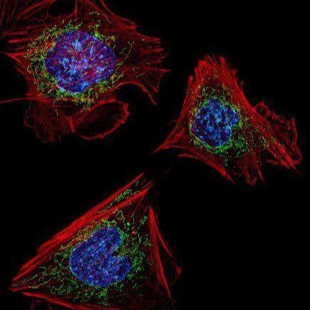 Raji细胞系、raji细胞株  raji细胞株