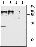 Orexin Receptor 2 antibody