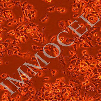 E0771小鼠乳腺癌细胞丨e0771细胞