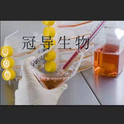 SKNEP Cells;人肾母细胞瘤扩增细胞|STR鉴定图谱