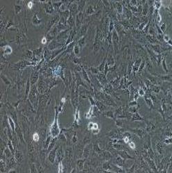 兔肝间质细胞永生化