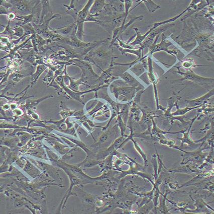 U87脑胶质瘤细胞