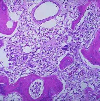 R15大鼠肝癌细胞实验