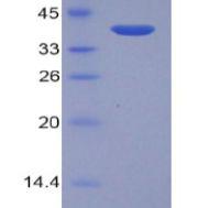 糖原磷酸化酶L(PYGL)重组蛋白(多属种)