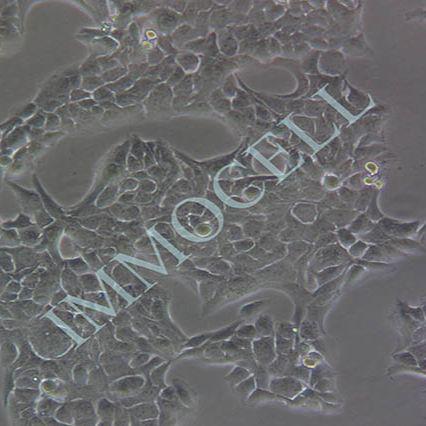 NCI-H2228人非小细胞肺癌细胞（STR鉴定）