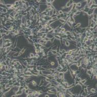 人肺癌腺癌细胞LC-2/AD