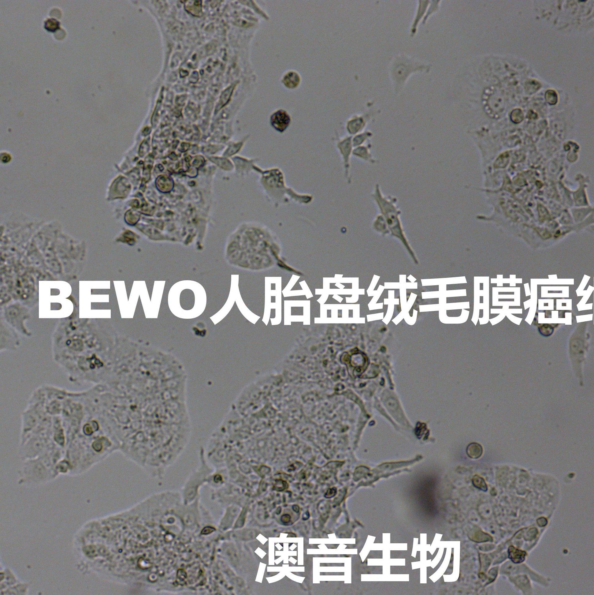 BEWO【Be Wo; Be-Wo；BeWo】人胎盘绒膜癌细胞